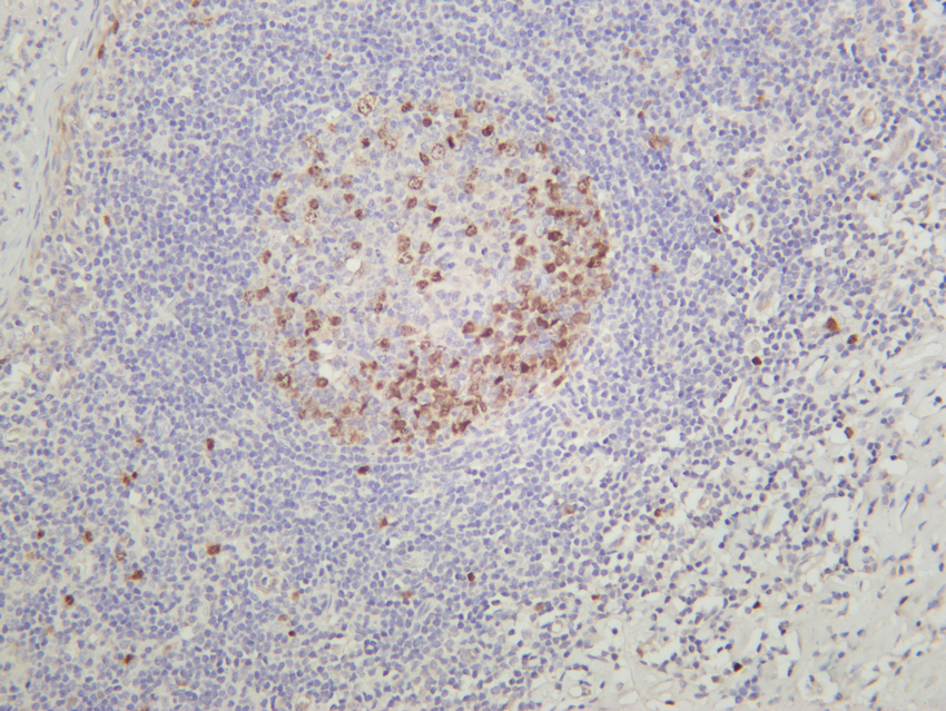 Aurora B (PT0246R) PT® Rabbit mAb